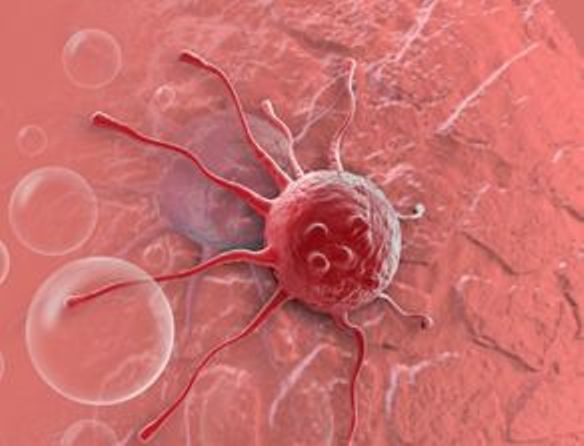 PNAS：抗癌新突破，UTA科学家使用纳米颗粒杀死癌细胞